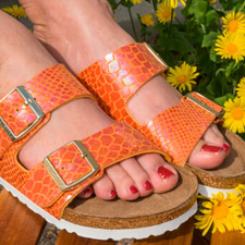 orange feet from birkenstocks